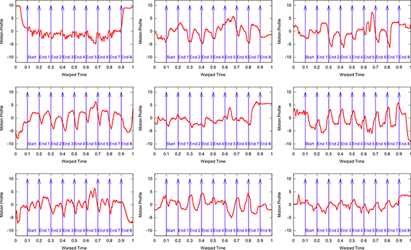 PCA Motion Profiles for A major Prelude* - individual motion profiles showing combinations of principal components explaining >90% of performance movements exhibited by each of the nine performers (Performers 1-9 represented as plots a-i in figure) (reproduced with permission from Musicae Scientiae)